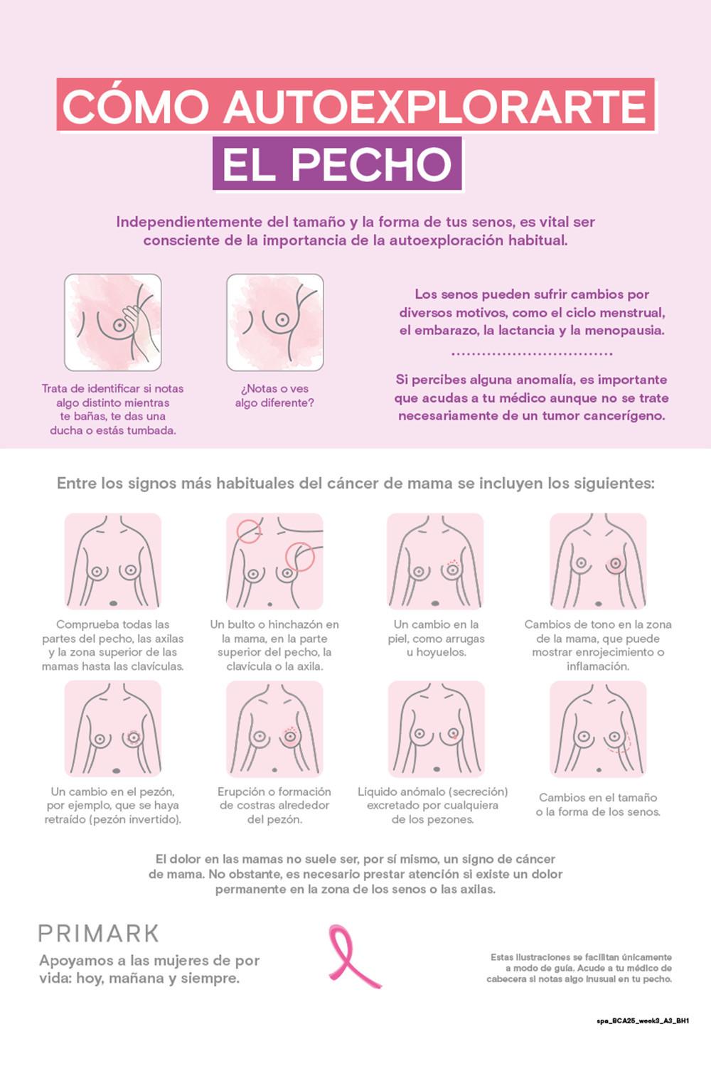 Infografía educativa que muestra cómo autoexplorarse el pecho para detectar cambios, con ilustraciones de las señales y síntomas más comunes del cáncer de mama.
