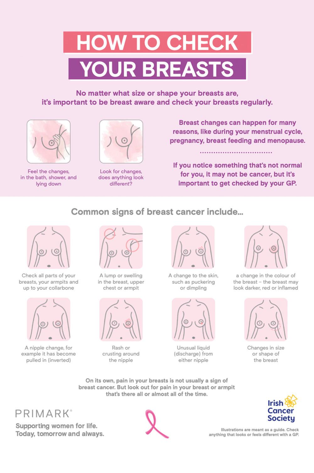 Educational infographic showing how to check breasts for changes with illustrations of common breast cancer signs and symptoms.