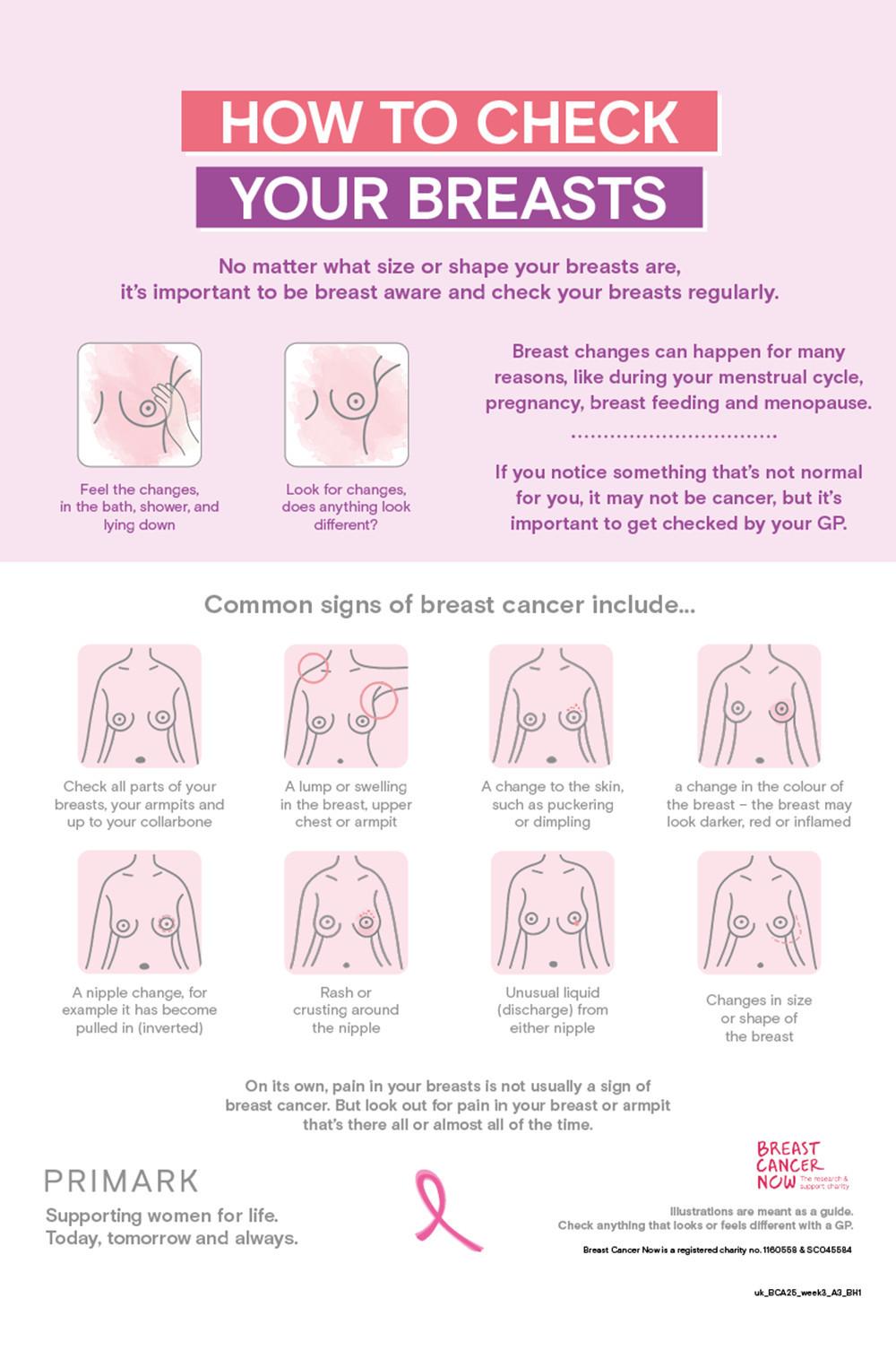 Educational infographic showing how to check breasts for changes with illustrations of common breast cancer signs and symptoms.