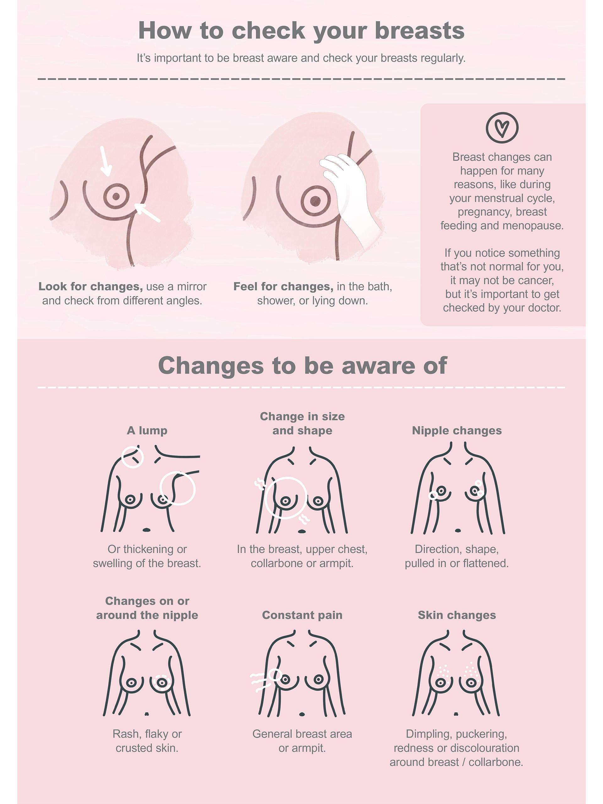 An Illustrated poster showing how to check your breasts and things to be aware of.