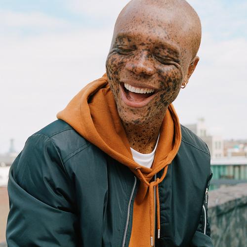 Modelo com camisola com capuz laranja e blusão verde